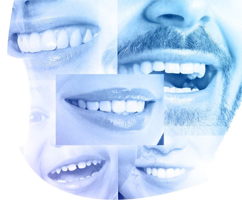 דלקת חניכיים: תסמינים, גורמים וטיפולים